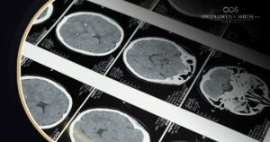 What Brain Injuries Can Occur from a Lack of Oxygen?